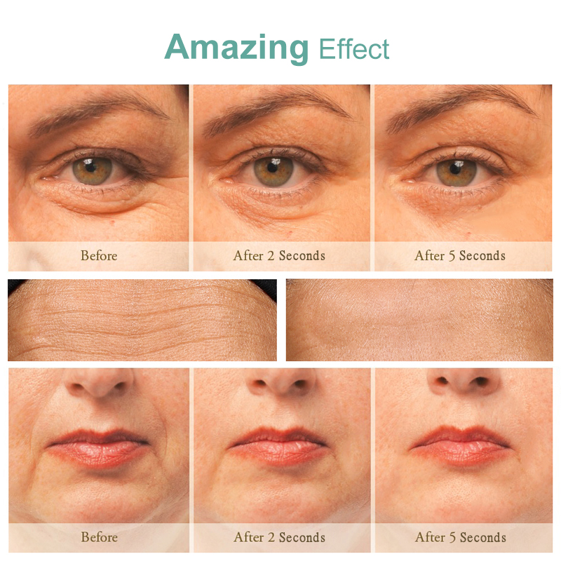 Wrinkles Removing Antioxidante Day Cream for Face