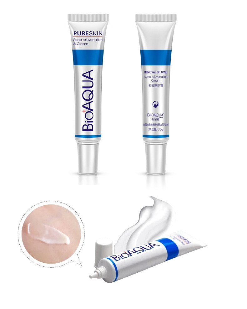 Acne Treatment and Oil Control Face Cream
